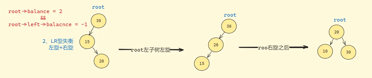 左右双旋